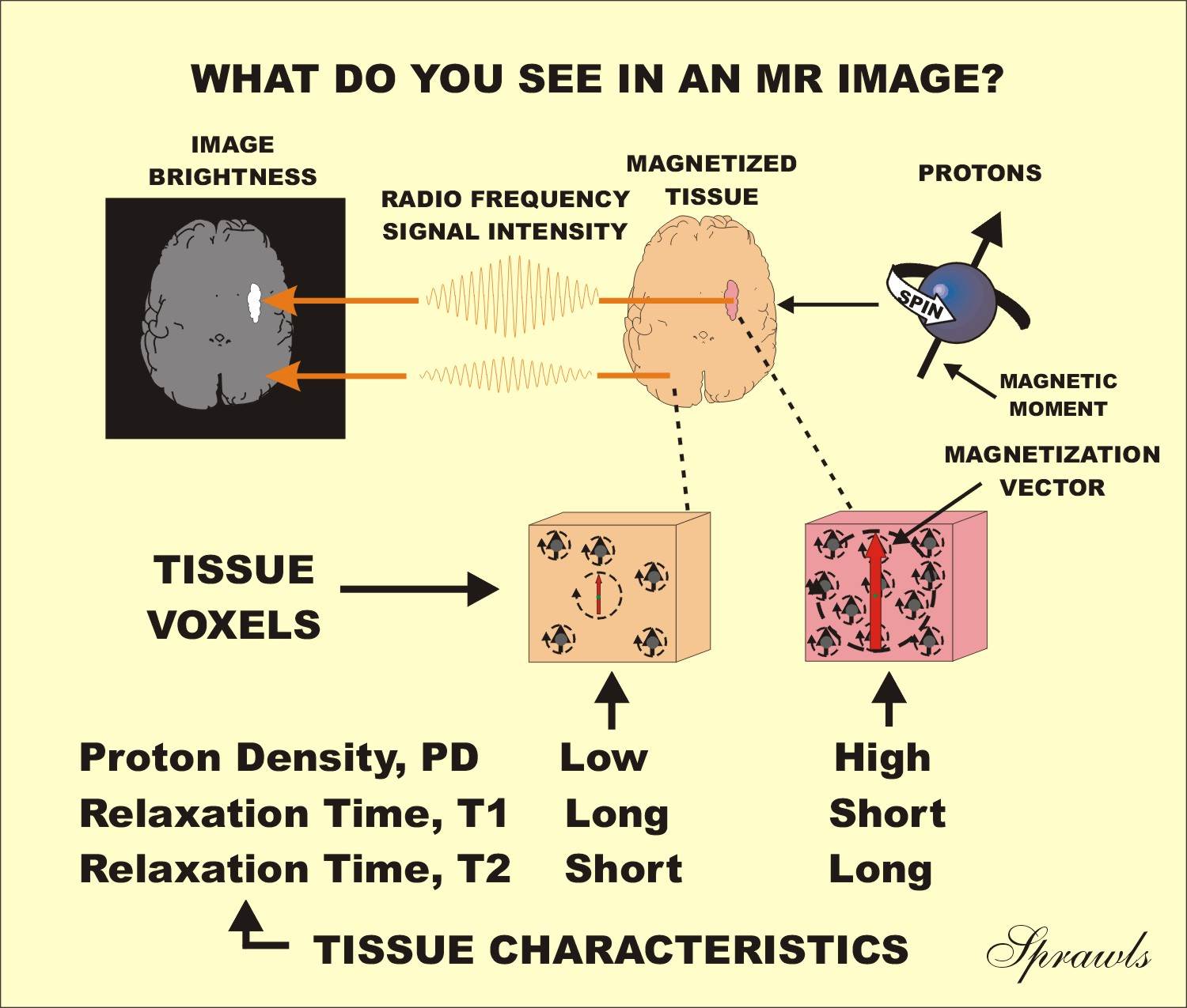 Resonance Image Characteristics